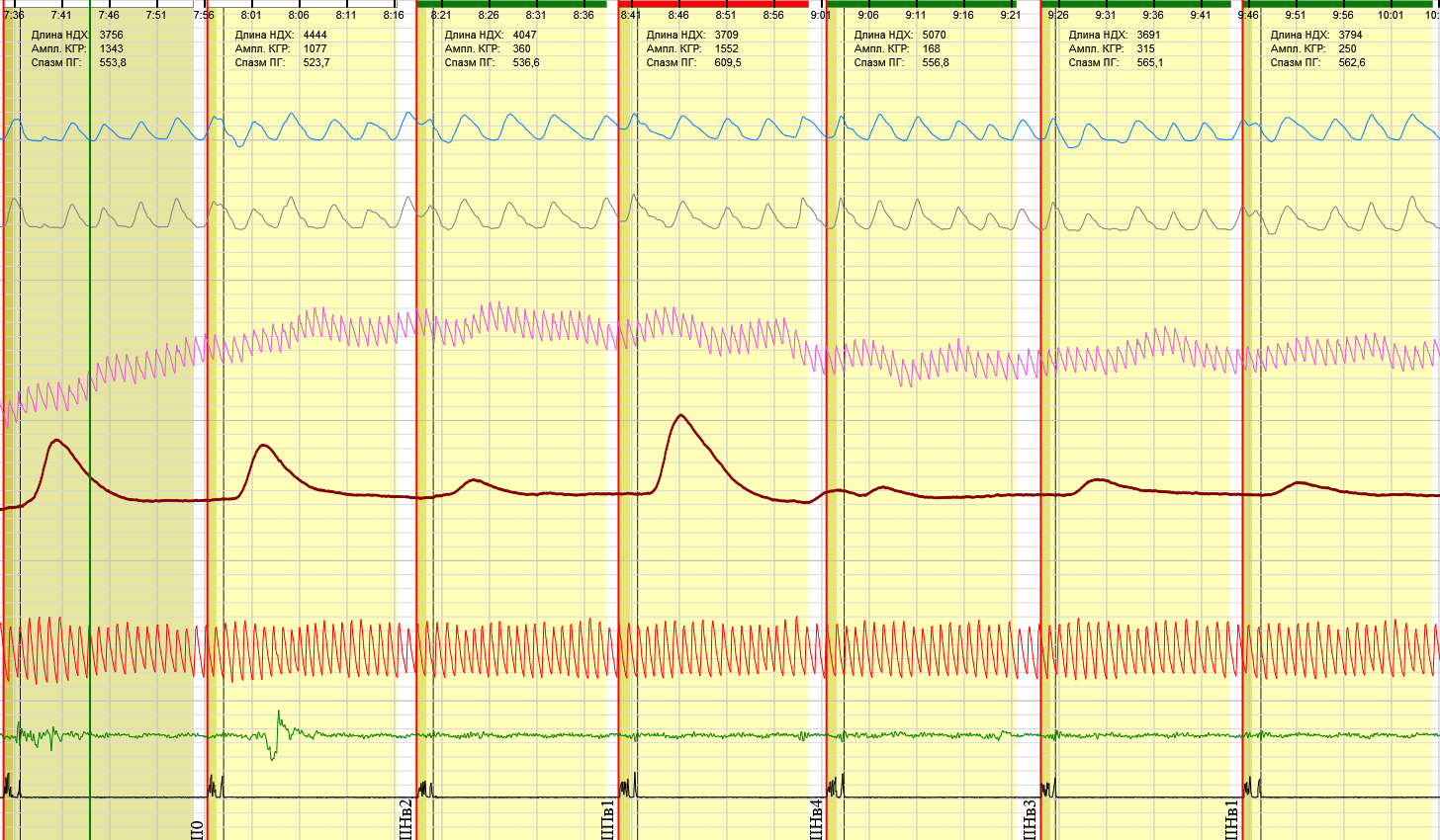 САТ на имя 2